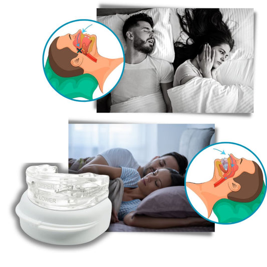 SilentEase | Anti-Snoring Mouth Device – Medical-Grade Silicone – Enhances Airflow – Ideal for Snorers Seeking Better Sleep