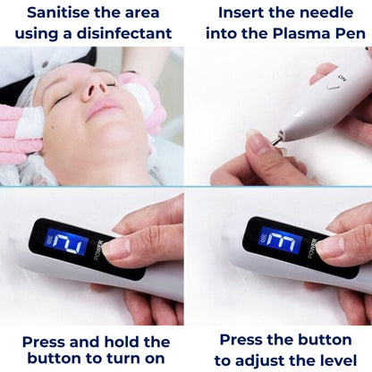 ClearSkinPro Laser Plasma Pen - Non-Invasive | for Freckle, Skin Tag, Spot, Mole and Tattoo Removal at Home