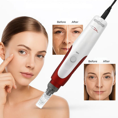 SkinRevive | Microneedling Derma Pen – Boost Collagen, Reduce Wrinkles & Scars, Improve Skin Texture & Tone – Professional Skincare Tool