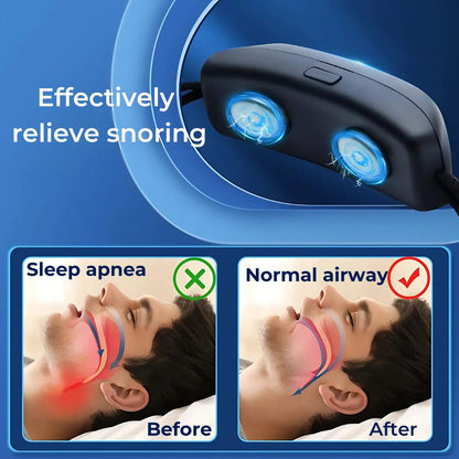 DreamEase Smart Anti-Snoring Device | Snore Stopper with Sleep Monitoring - Gentle Vibration for Better Sleep Quality