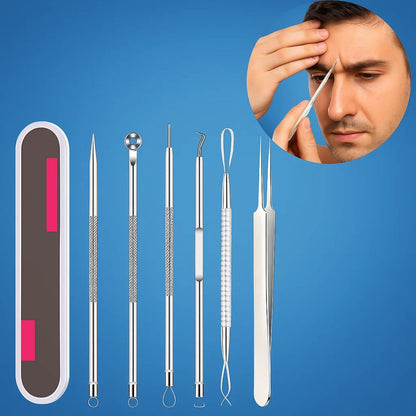 PurePore | Blackhead Remover Tool Kit – Stainless Steel – Travel Case – Easy Spot Removal – Clear Smooth Skin – At-Home & On-the-Go Care