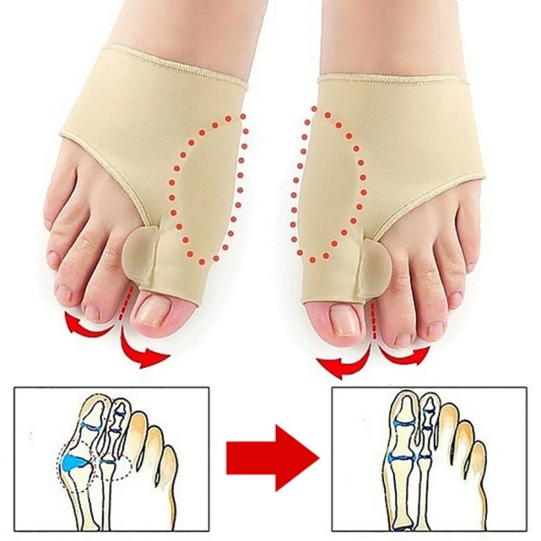 AlignWell Bunion Corrector Toe Separator | for Big Toe Realignment and Pain Relief – Non-Invasive Solution for Bunions