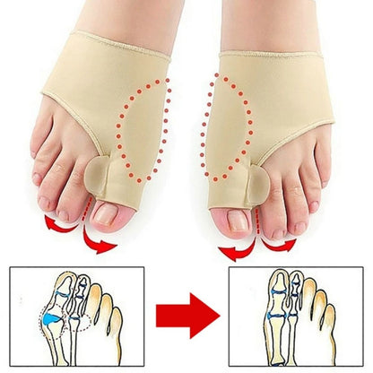 AlignWell Bunion Corrector Toe Separator | for Big Toe Realignment and Pain Relief – Non-Invasive Solution for Bunions