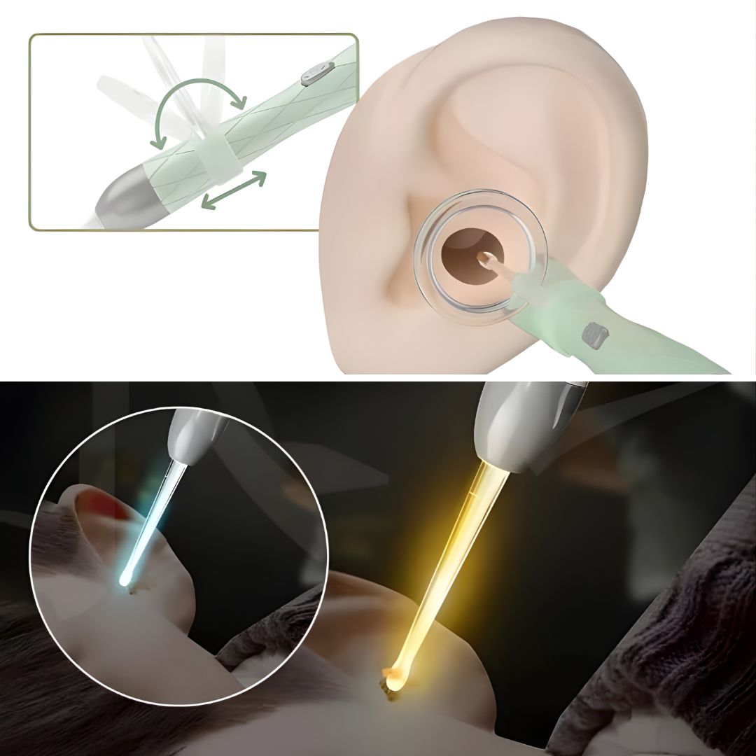 EarLumina | Ear Wax Removal Kit – LED-Illuminated Precision Cleaning – Stainless Steel – Safe Gentle Ear Care for Adults & Children