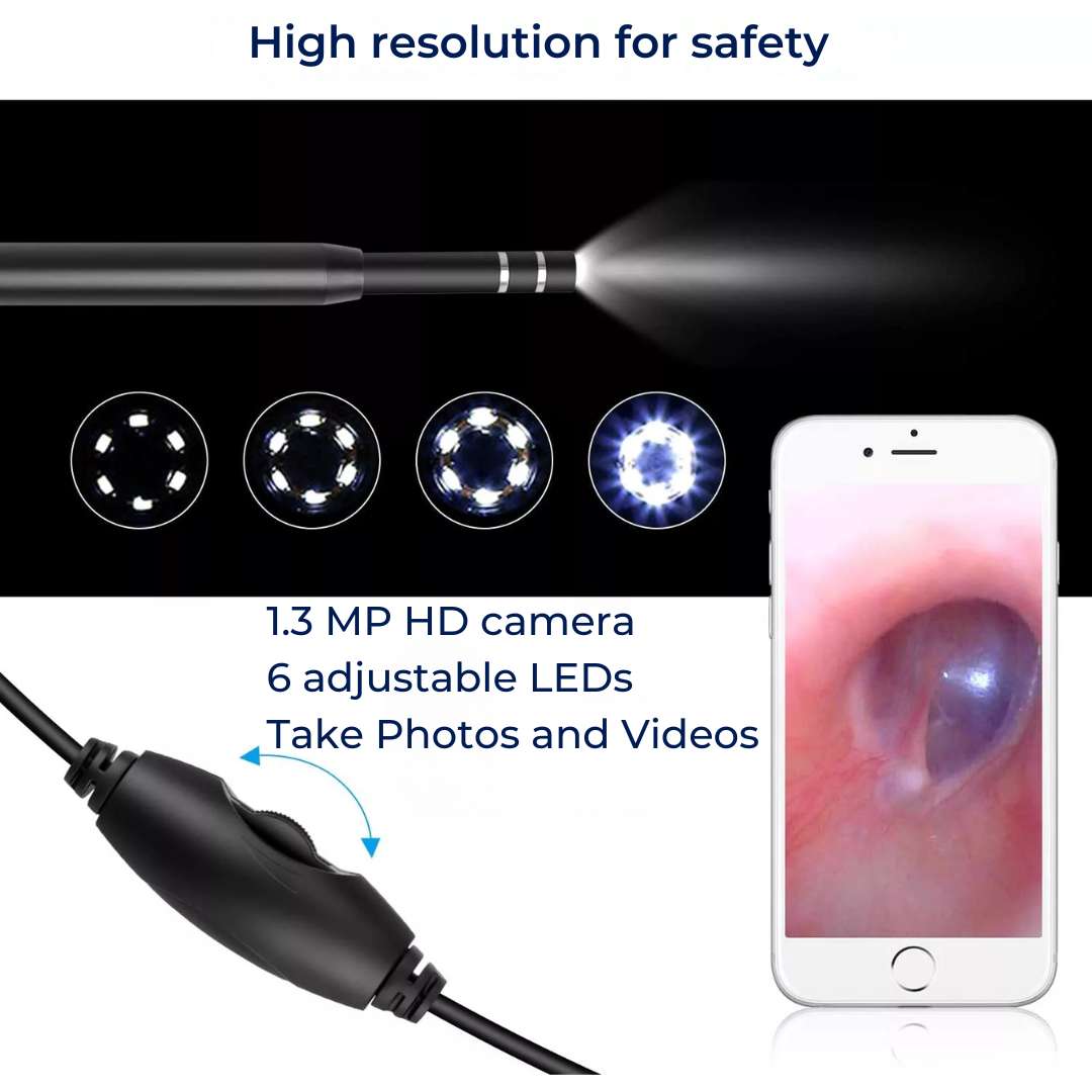 EarVision Professional Ear Endoscope – HD Inspection – Live Monitoring – Capture Images & Video – Removes Wax & Foreign Objects