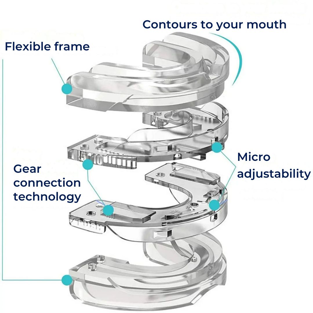 SilentEase | Anti-Snoring Mouth Device – Medical-Grade Silicone – Enhances Airflow – Ideal for Snorers Seeking Better Sleep