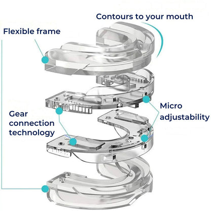 SilentEase | Anti-Snoring Mouth Device – Medical-Grade Silicone – Enhances Airflow – Ideal for Snorers Seeking Better Sleep