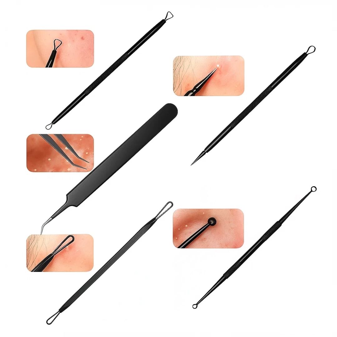 PurePore | Blackhead Remover Tool Kit – Stainless Steel – Travel Case – Easy Spot Removal – Clear Smooth Skin – At-Home & On-the-Go Care