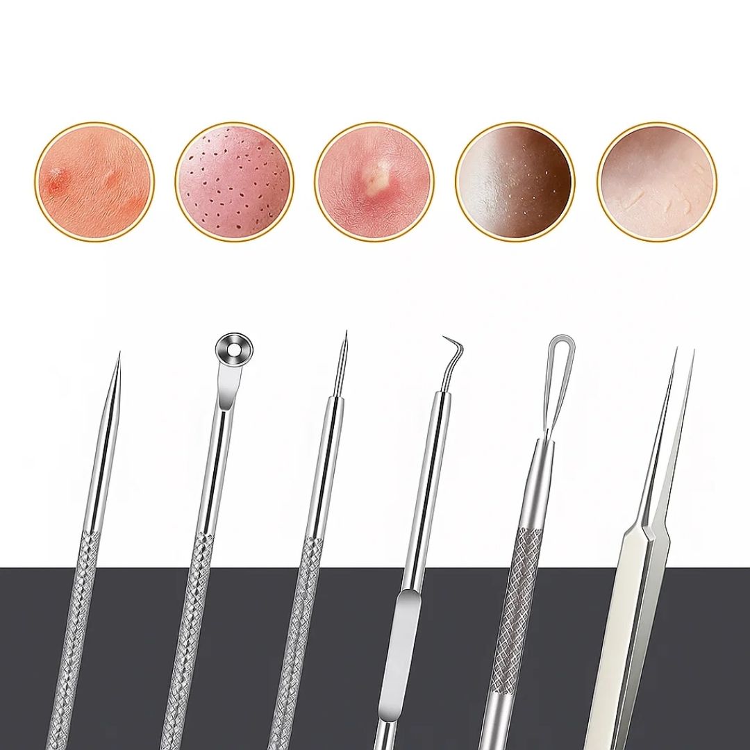 PurePore | Blackhead Remover Tool Kit – Stainless Steel – Travel Case – Easy Spot Removal – Clear Smooth Skin – At-Home & On-the-Go Care