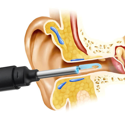 EarScope Pro - Smart Visual Earwax Removal Tool | LED Camera and Soft Tips - Safe and Precise Ear Cleaning