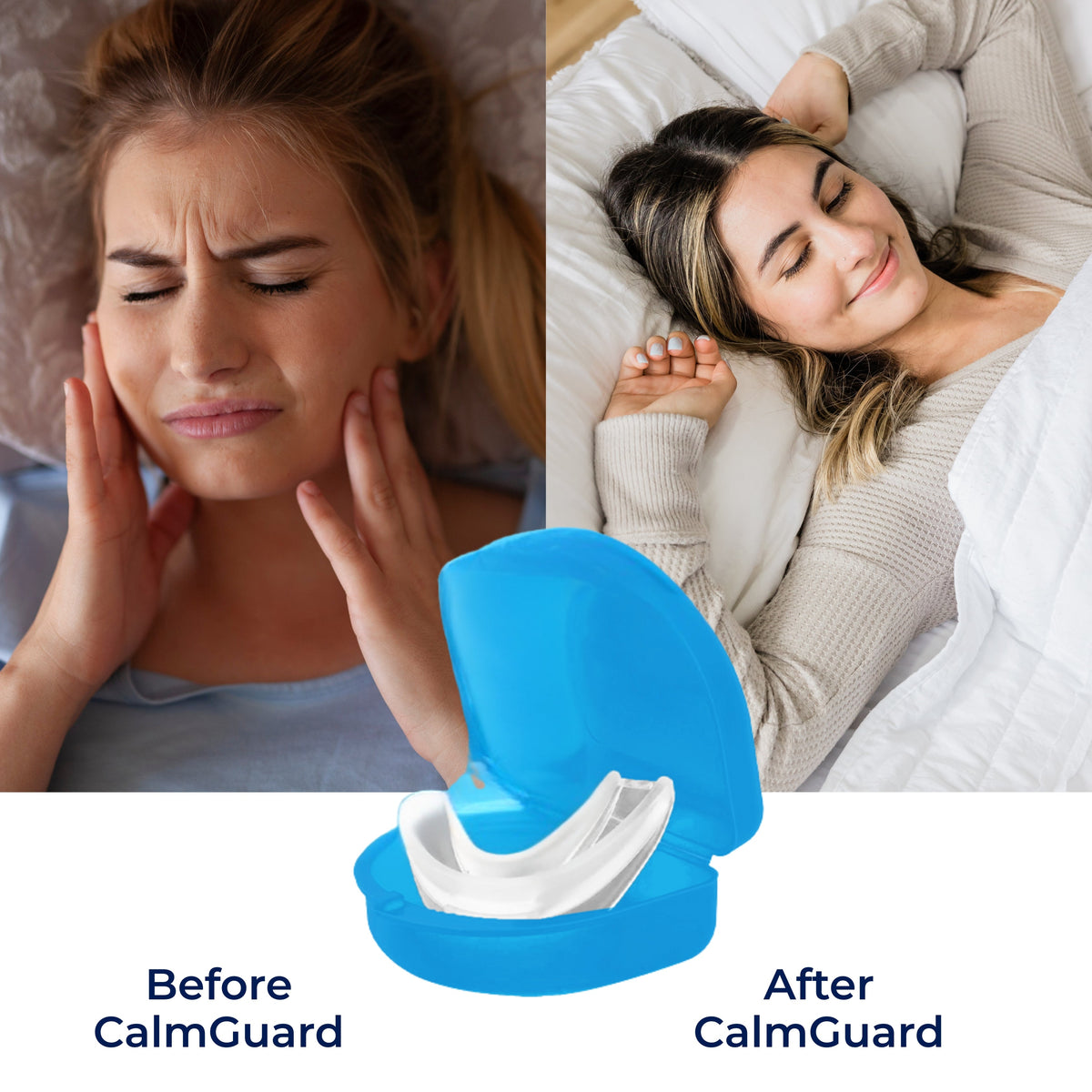 CalmGuard | Night Mouth Guard – Bruxism Relief – Custom-Fit – For Teeth Grinding & Jaw Clenching