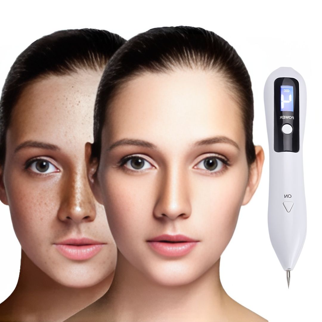 ClearSkinPro Laser Plasma Pen - Non-Invasive | for Freckle, Skin Tag, Spot, Mole and Tattoo Removal at Home