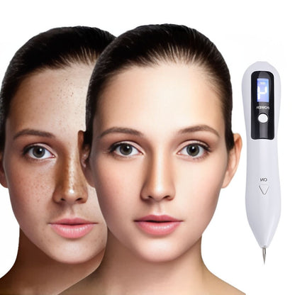 ClearSkinPro Laser Plasma Pen - Non-Invasive | for Freckle, Skin Tag, Spot, Mole and Tattoo Removal at Home