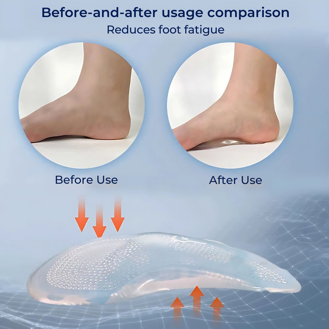 ComfortStep Gel Arch Support Insoles | Relieve Foot Pain - Reduce Fatigue - Improve Posture - Shock Absorbing Insoles