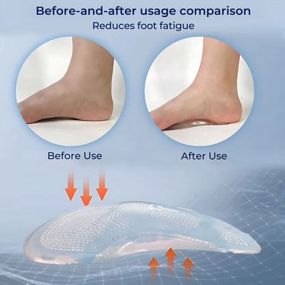 ComfortStep Gel Arch Support Insoles | Relieve Foot Pain - Reduce Fatigue - Improve Posture - Shock Absorbing Insoles