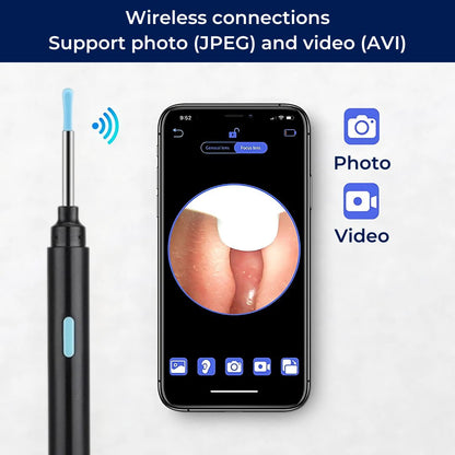 EarScope Pro - Smart Visual Earwax Removal Tool | LED Camera and Soft Tips - Safe and Precise Ear Cleaning
