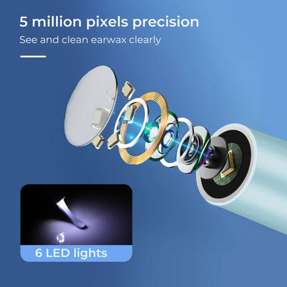EarScope Pro - Smart Visual Earwax Removal Tool | LED Camera and Soft Tips - Safe and Precise Ear Cleaning