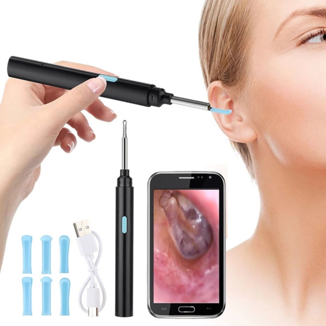 EarScope Pro - Smart Visual Earwax Removal Tool | LED Camera and Soft Tips - Safe and Precise Ear Cleaning