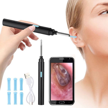 EarScope Pro - Smart Visual Earwax Removal Tool | LED Camera and Soft Tips - Safe and Precise Ear Cleaning