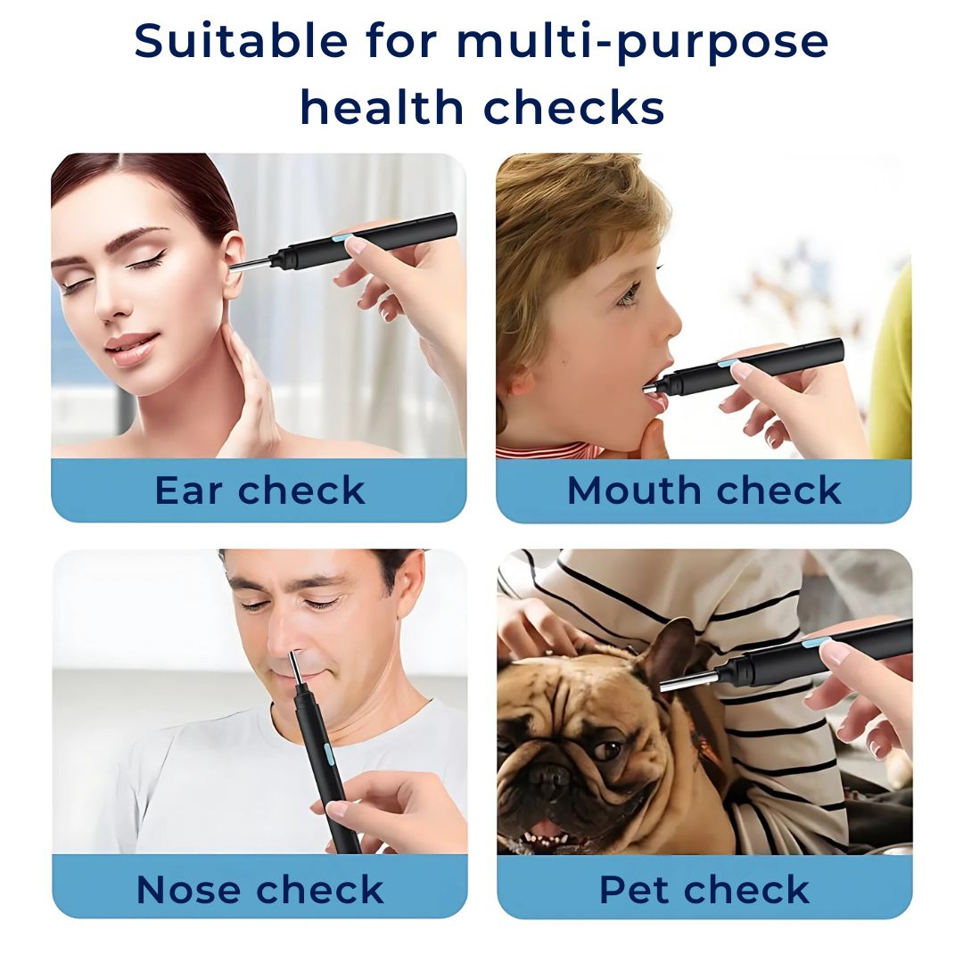 EarScope Pro - Smart Visual Earwax Removal Tool | LED Camera and Soft Tips - Safe and Precise Ear Cleaning