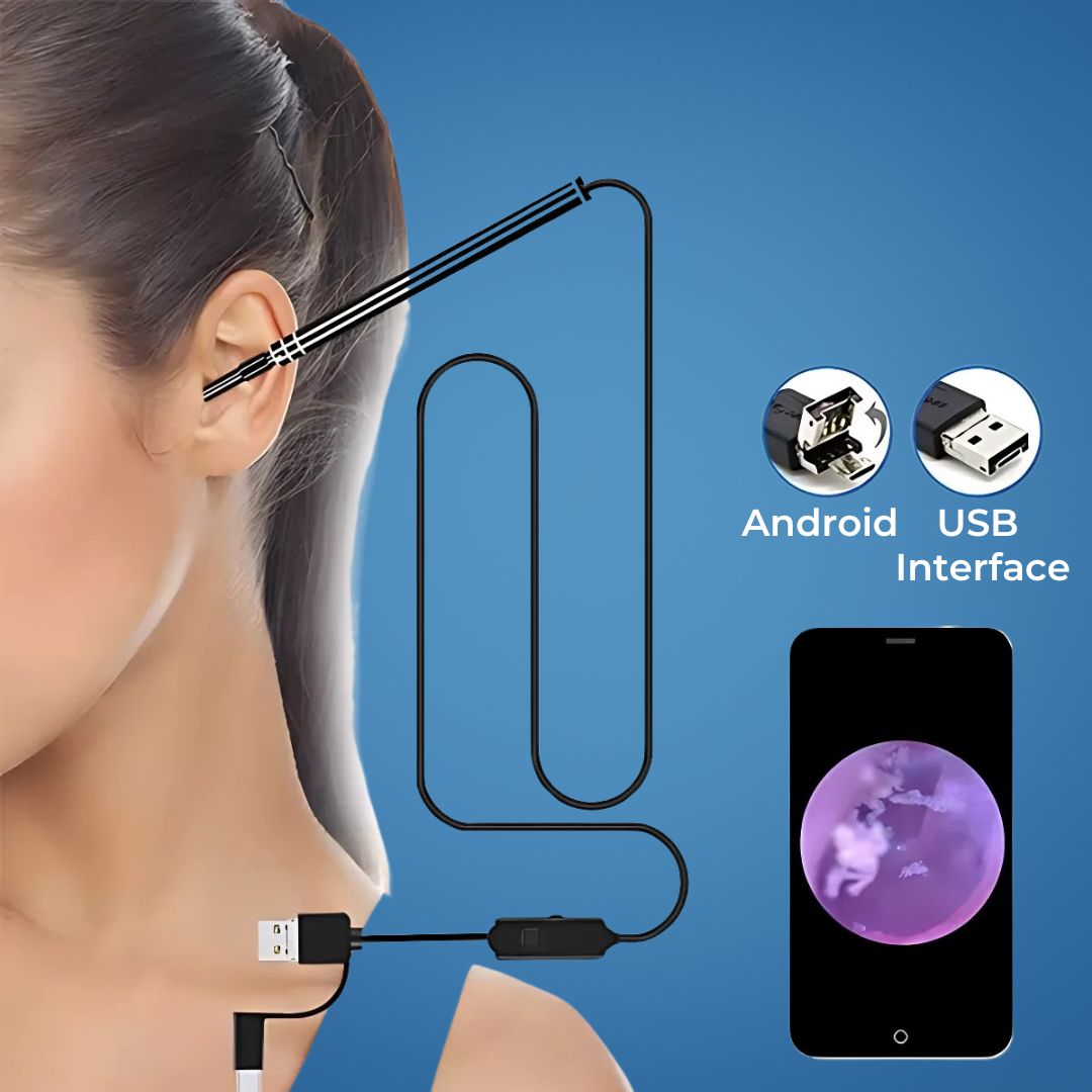 EarVision Professional Ear Endoscope – HD Inspection – Live Monitoring – Capture Images & Video – Removes Wax & Foreign Objects