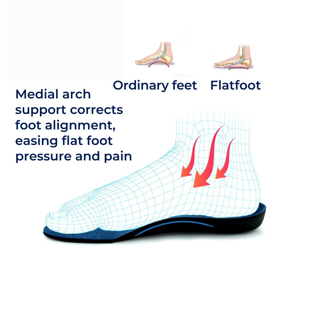 OrthoAlign Pronation Support | Inserts for Foot Alignment and Arch Relief - Orthopedic Shoe Inserts for Overpronation Correction